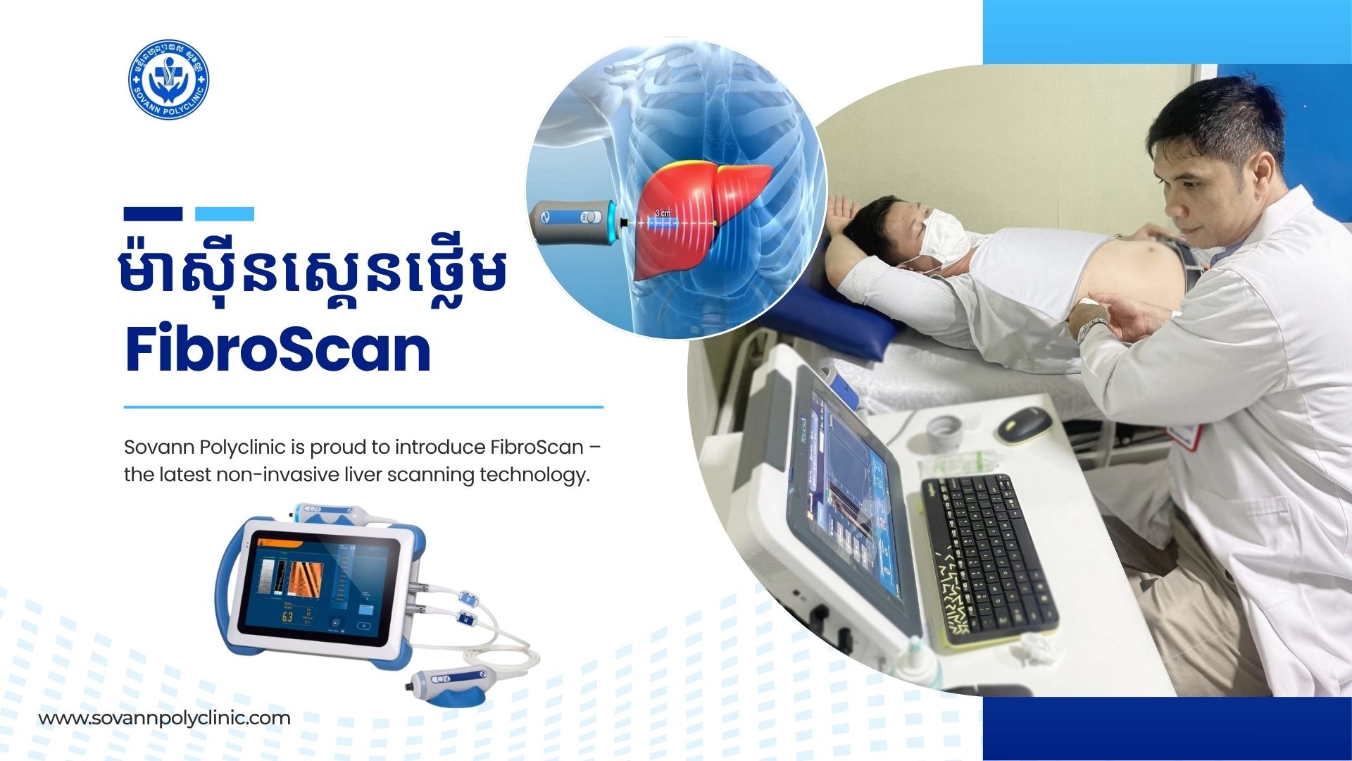 Now Available: FibroScan Test