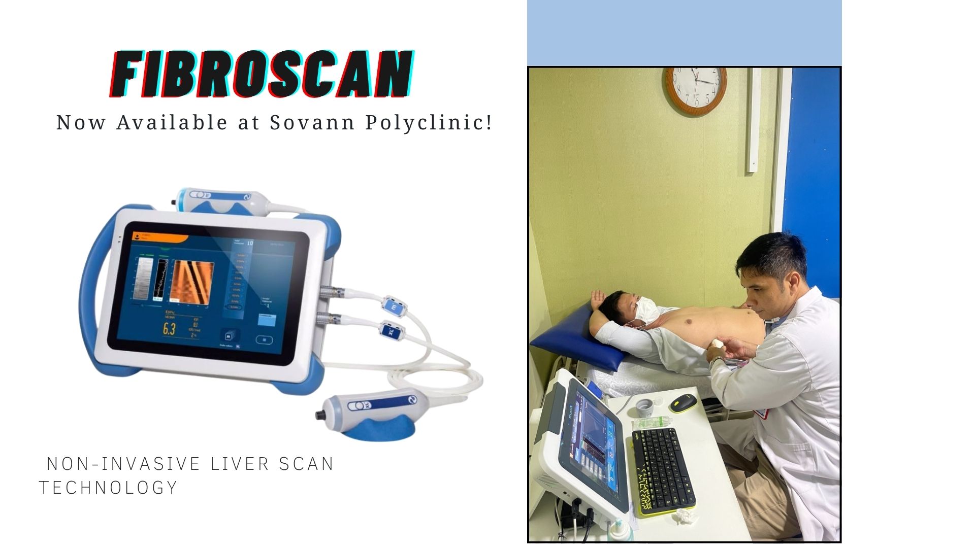 Now Available: FibroScan Test